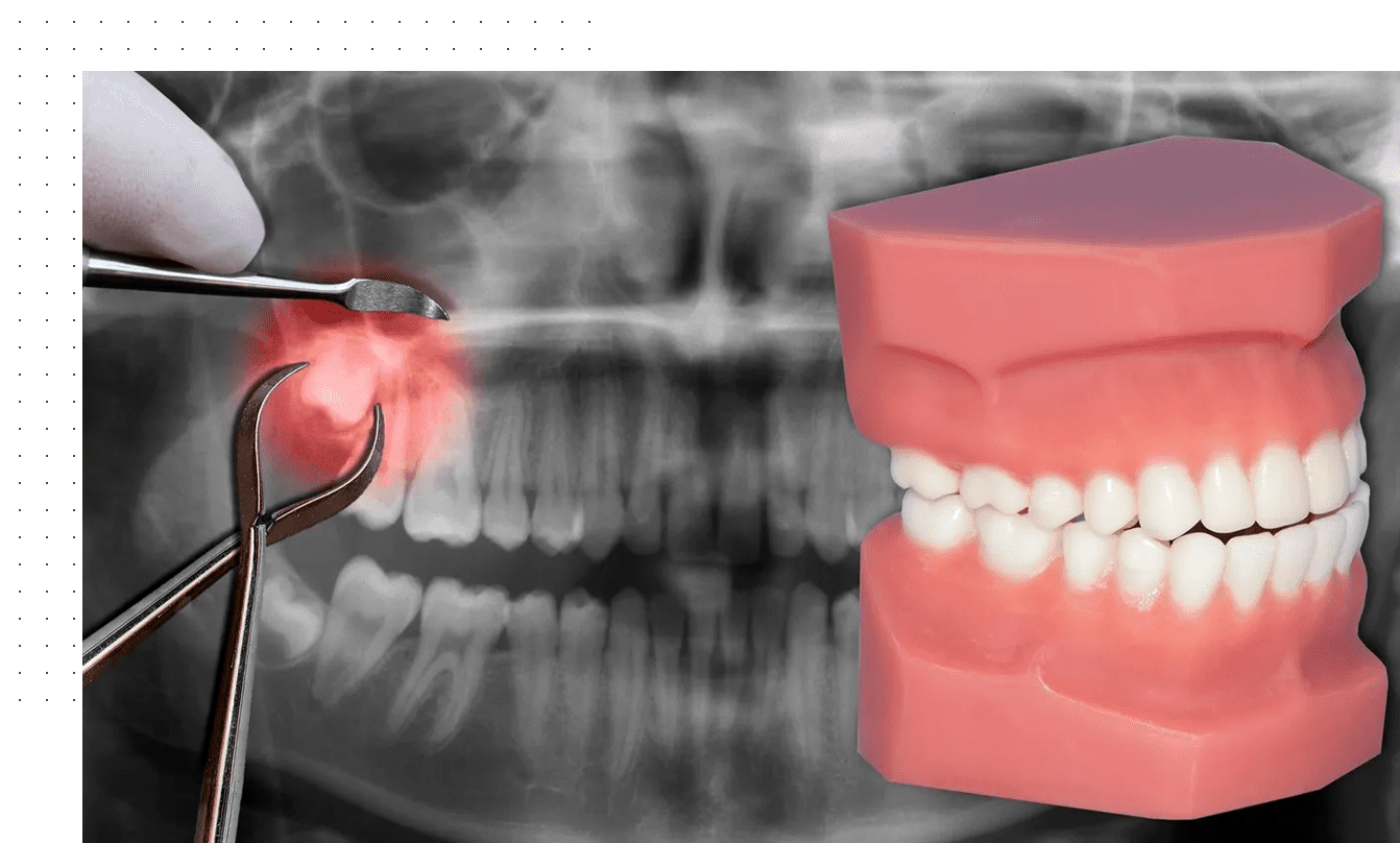 A dentist is examining the teeth of an adult patient.